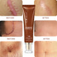 Moisturizing And Repairing Scar Skin Care Cream
