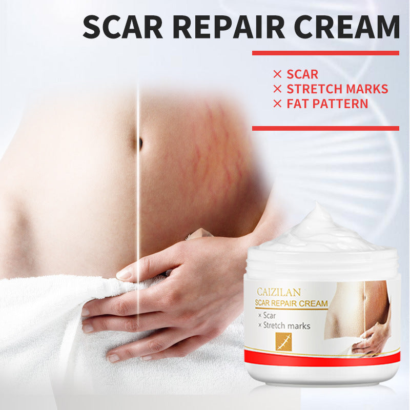 Pregnant Women Acne Scar Repair Cream Skin Care 30g